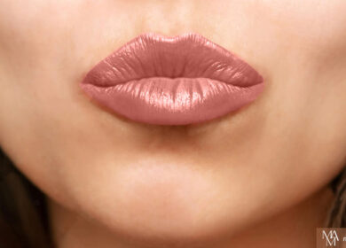 What Are The Different Types Of Lip Injections?