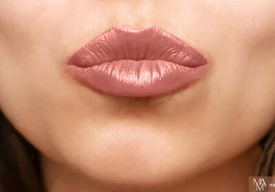 What Are The Different Types Of Lip Injections?