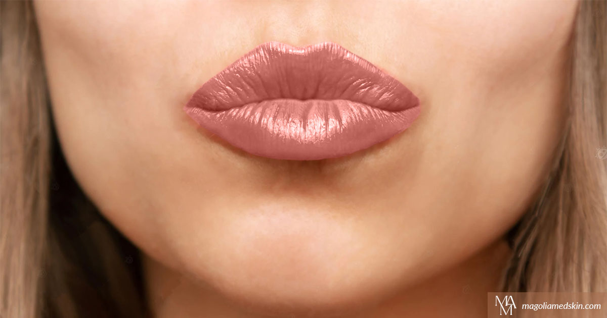 What Are The Different Types Of Lip Injections?