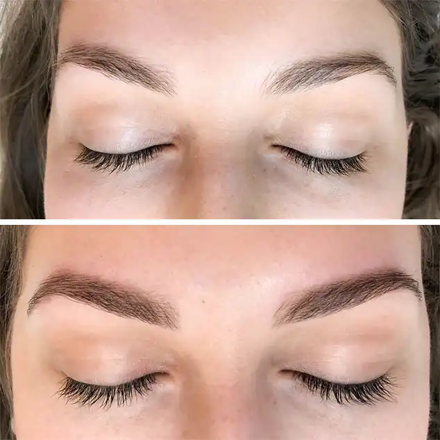 Patient 1 Eyebrow Tinting San Antonio Before and After