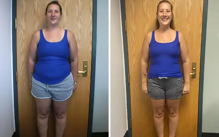 Patient 2 Medical Weight Loss San Antonio Before & After Photos