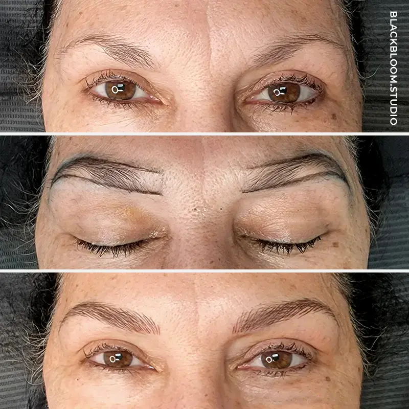 Patient 5 Microblading Before & After Photos Magnolia Medical & Aesthetics Texas