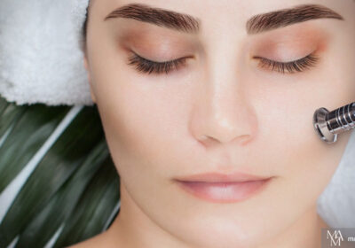 Benefits Of Microdermabrasion