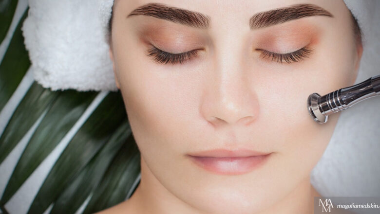 Benefits Of Microdermabrasion