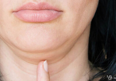 How To Get Rid Of The Dreaded Double Chin