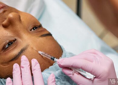 What Age To Start Getting Botox