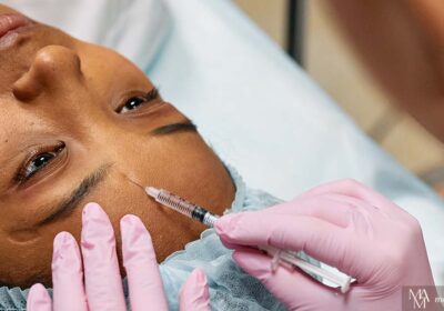 What Age To Start Getting Botox