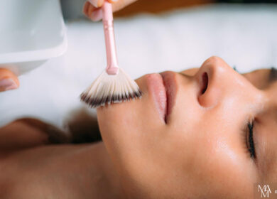 Why Get A Chemical Peel On Your Face