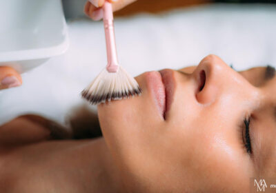 Why Get A Chemical Peel On Your Face