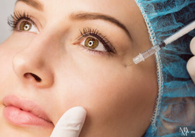 Beyond Wrinkle Reduction: Surprising Uses For Botox