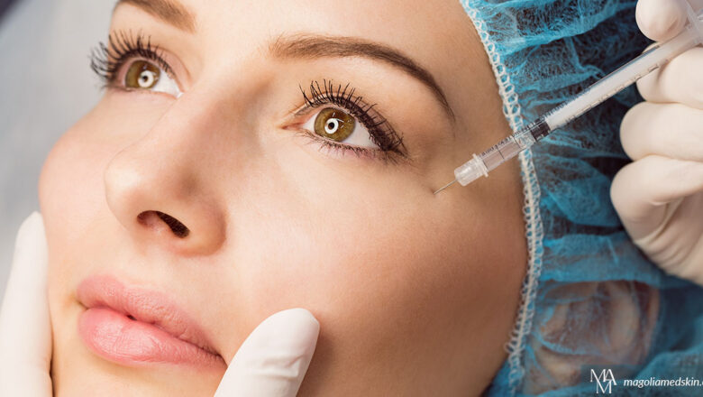 Beyond Wrinkle Reduction: Surprising Uses For Botox