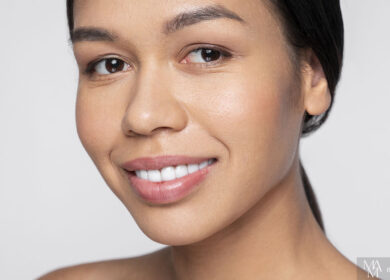 What Can Chemical Peels Do For Your Skin?