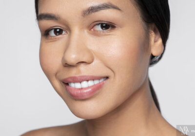 What Can Chemical Peels Do For Your Skin?