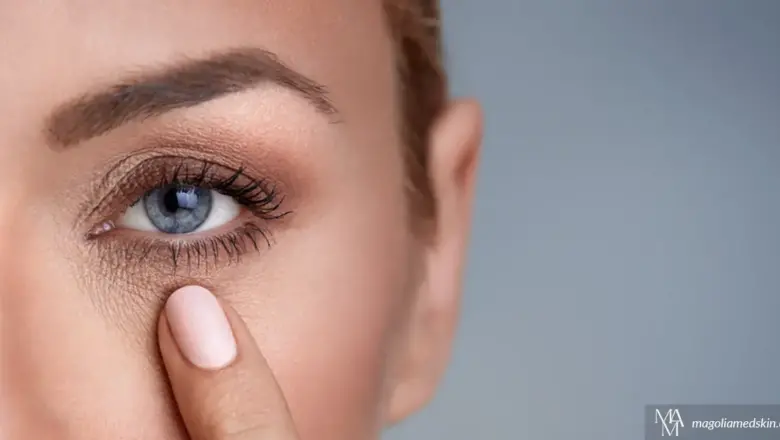 Treatments To Reduce Under Eye Wrinkles | Magnolia Medical & Aesthetics
