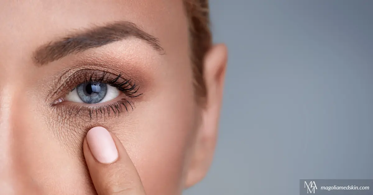 Treatments To Reduce Under Eye Wrinkles | Magnolia Medical & Aesthetics