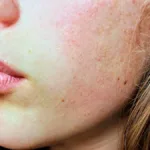 Fight Winter Dryness With These Medical-Grade Medspa Skin Products
