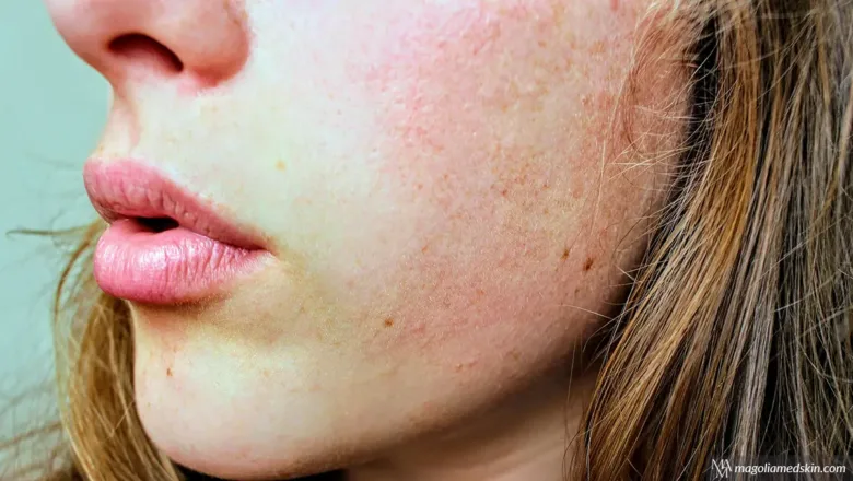 Fight Winter Dryness With These Medical-Grade Medspa Skin Products