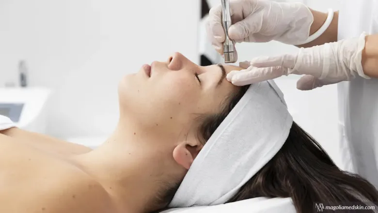 What Does Microdermabrasion Do For Your Face? | Magnolia Medical & Aesthetics