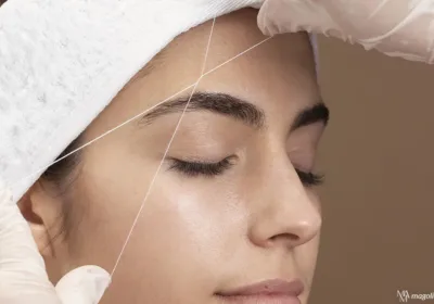 Rediscover Youth with Thread Lift Facial Rejuvenation Treatment in San Antonio