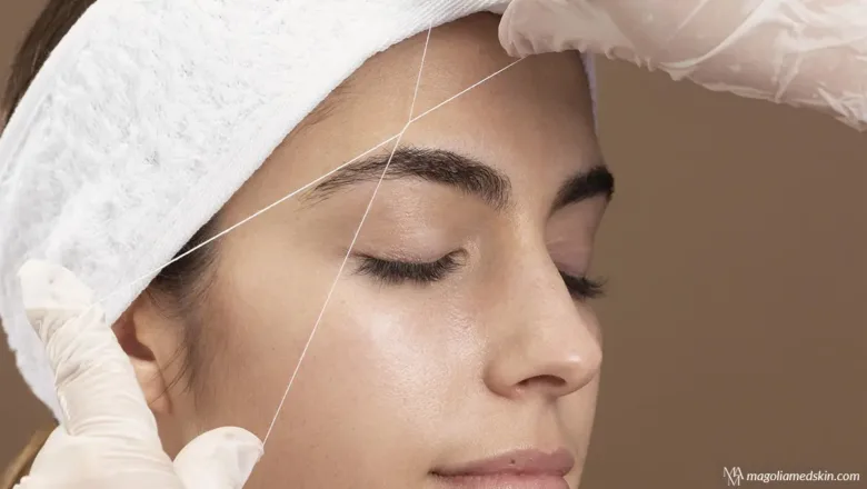 Rediscover Youth with Thread Lift Facial Rejuvenation Treatment in San Antonio