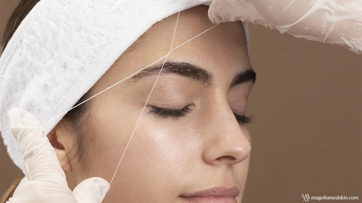 Rediscover Youth with Thread Lift Facial Rejuvenation Treatment in San Antonio