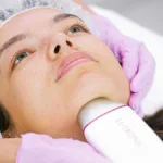 Erbium Laser Resurfacing at Magnolia Medical & Aesthetics