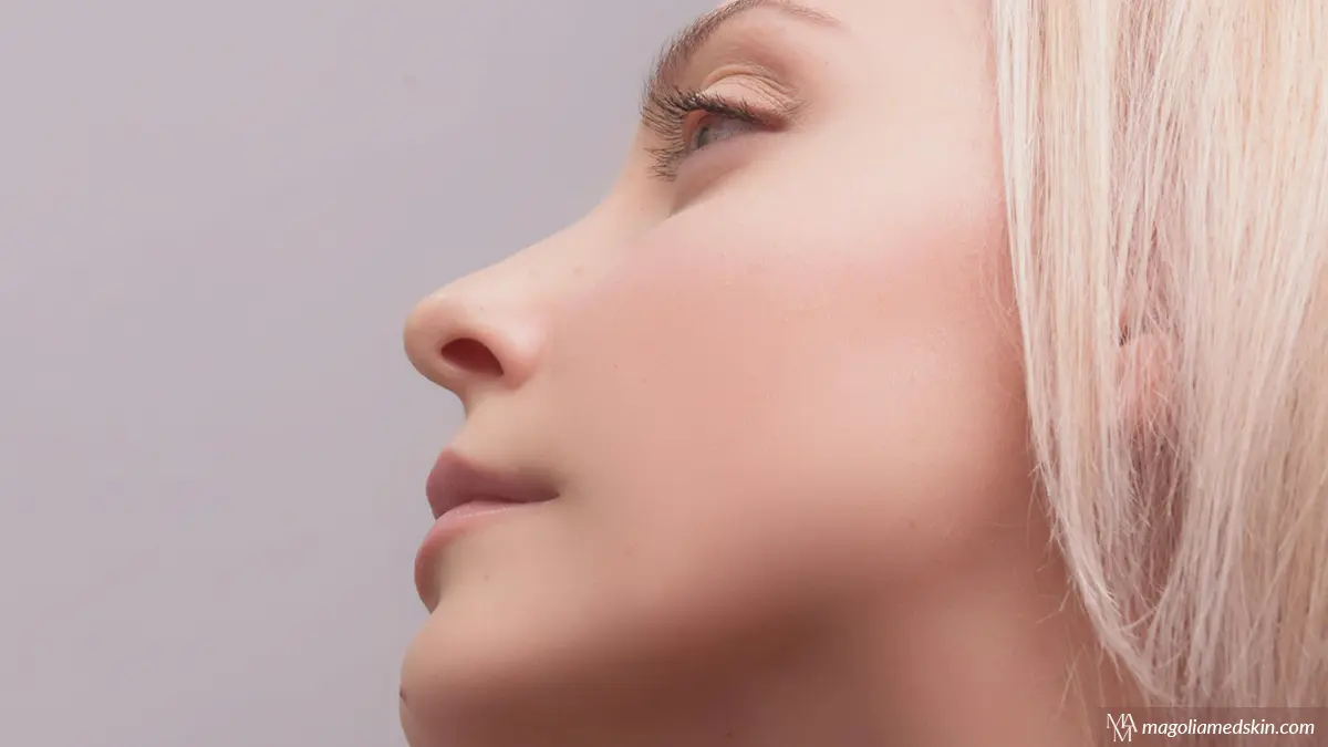 Juvederm FAQs at Magnolia Medical & Aesthetics San Antonio