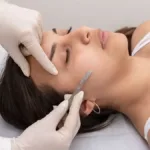 Professional Dermaplaning Treatments in San Antonio at Magnolia Medical & Aesthetics