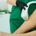 Facts About Laser Hair Removal You Should Know Before Treatment