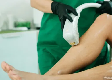 Facts About Laser Hair Removal You Should Know Before Treatment