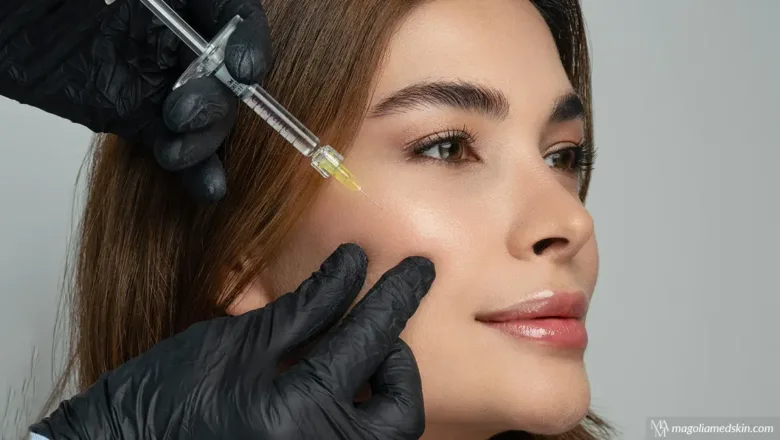 Signs You Need Dermal Fillers | Magnolia Medical & Aesthetics
