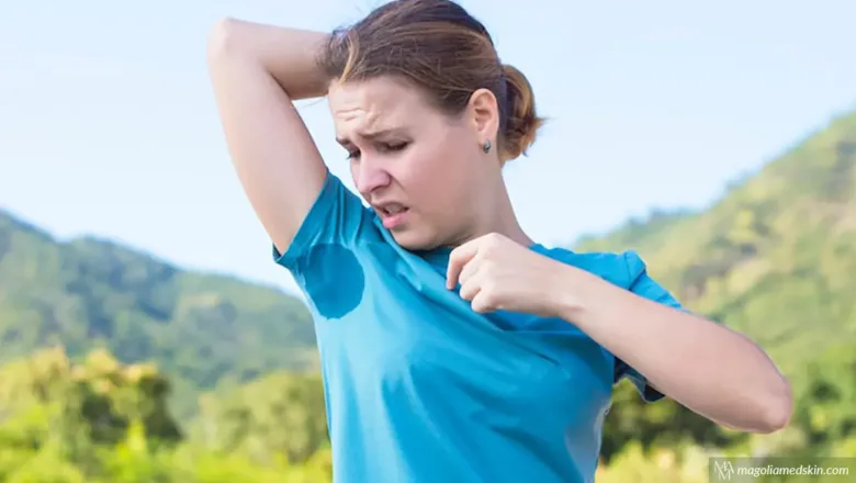 Botox for Excessive Sweating in San Antonio by Magnolia Medical & Aesthetics