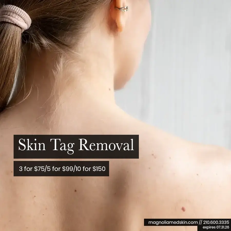 Skin Tag Removal Special Offer